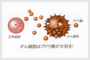 がん細胞